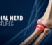 Radial Head Fractures